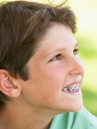 early orthodontic treatment