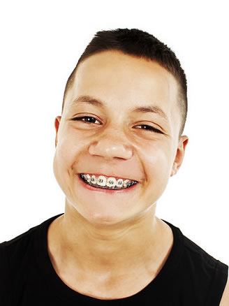 orthodontic faqs